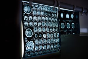 An X-ray showing multiple brain scans.