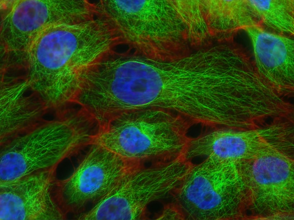 Novel Cancer Therapies
