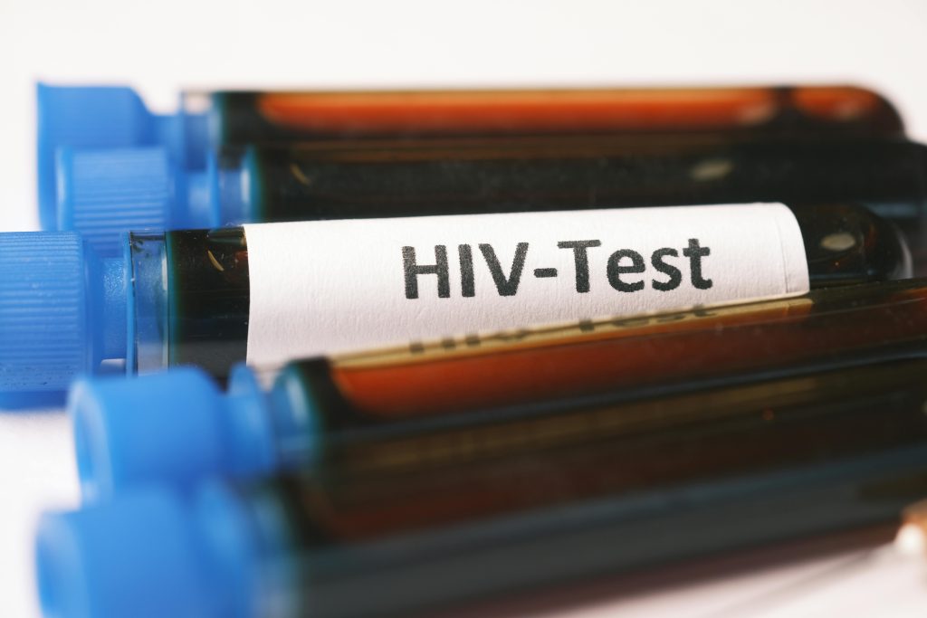 The Anatomy of Despair: The Impact of HIV/Aids