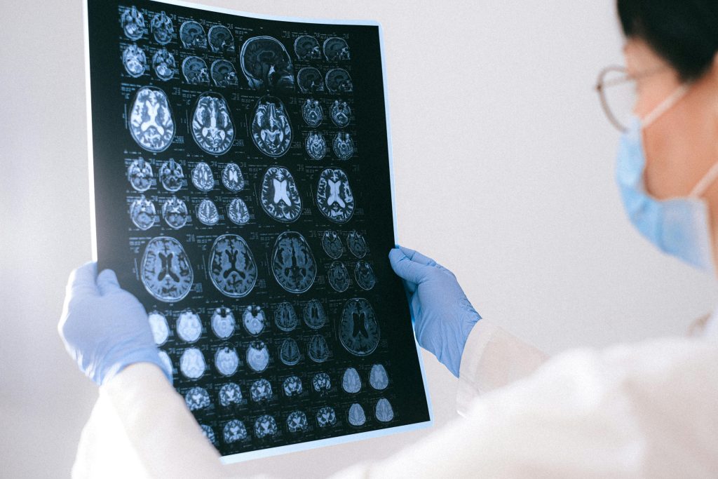 The Great Big Alzheimer's Puzzle