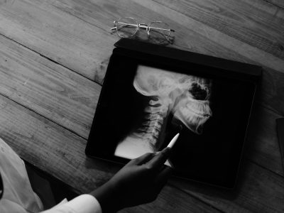 AI's Potential in Radiology: Reducing Burnout and Enhancing Efficiency