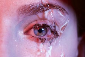 Eye with intense tears.